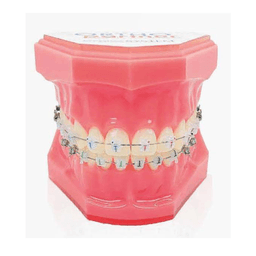 Brackets autoligaturants GENIUS CRYSTAL U 5-5 L 3-3 Hks 3 8