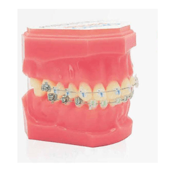 Brackets autoligaturants GENIUS CRYSTAL U 5-5 L 3-3 Hks 3 9