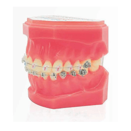 Brackets autoligaturants GENIUS CRYSTAL U 5-5 L 3-3 Hks 3 10