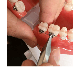 Pince à décoller les brackets céramiques et métalliques 4