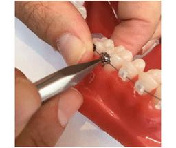Pince à décoller les brackets céramiques et métalliques 5