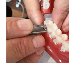 Pince à décoller les brackets céramiques et métalliques 7