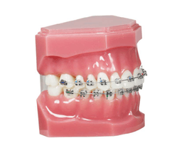 Brackets Smart Twin MBT .022X.028 5x5 U/L Hk345 - 20pcs 5