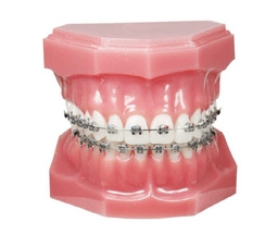Brackets Smart Twin MBT .022X.028 5x5 U/L Hk345 - 20pcs 6