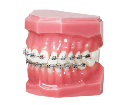 Brackets Smart Twin MBT .022X.028 5x5 U/L Hk345 - 20pcs 7
